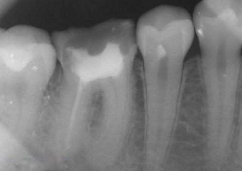 中國(guó)再生牙齒研究新進(jìn)展，重塑微笑，科技引領(lǐng)牙齒再生新篇章