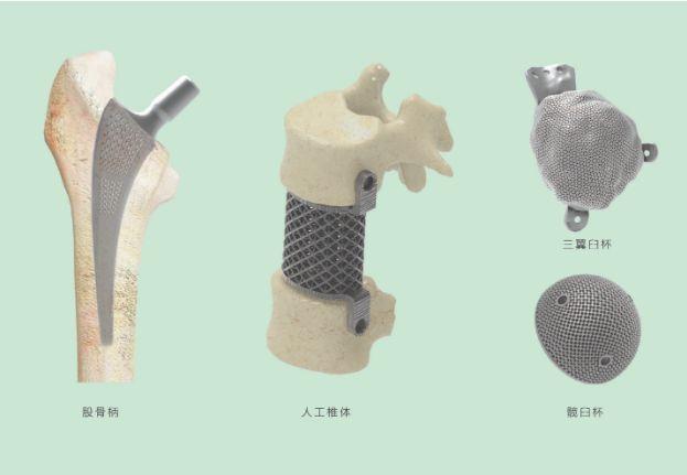 三維打印髖關(guān)節(jié)技術(shù)新動(dòng)態(tài)，重塑生活的科技魔法奇跡